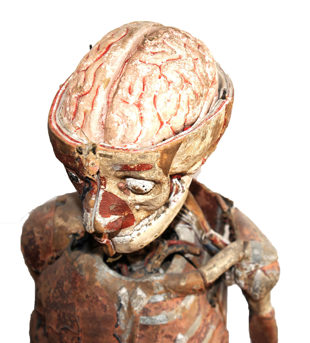 Enlarged image for image #4