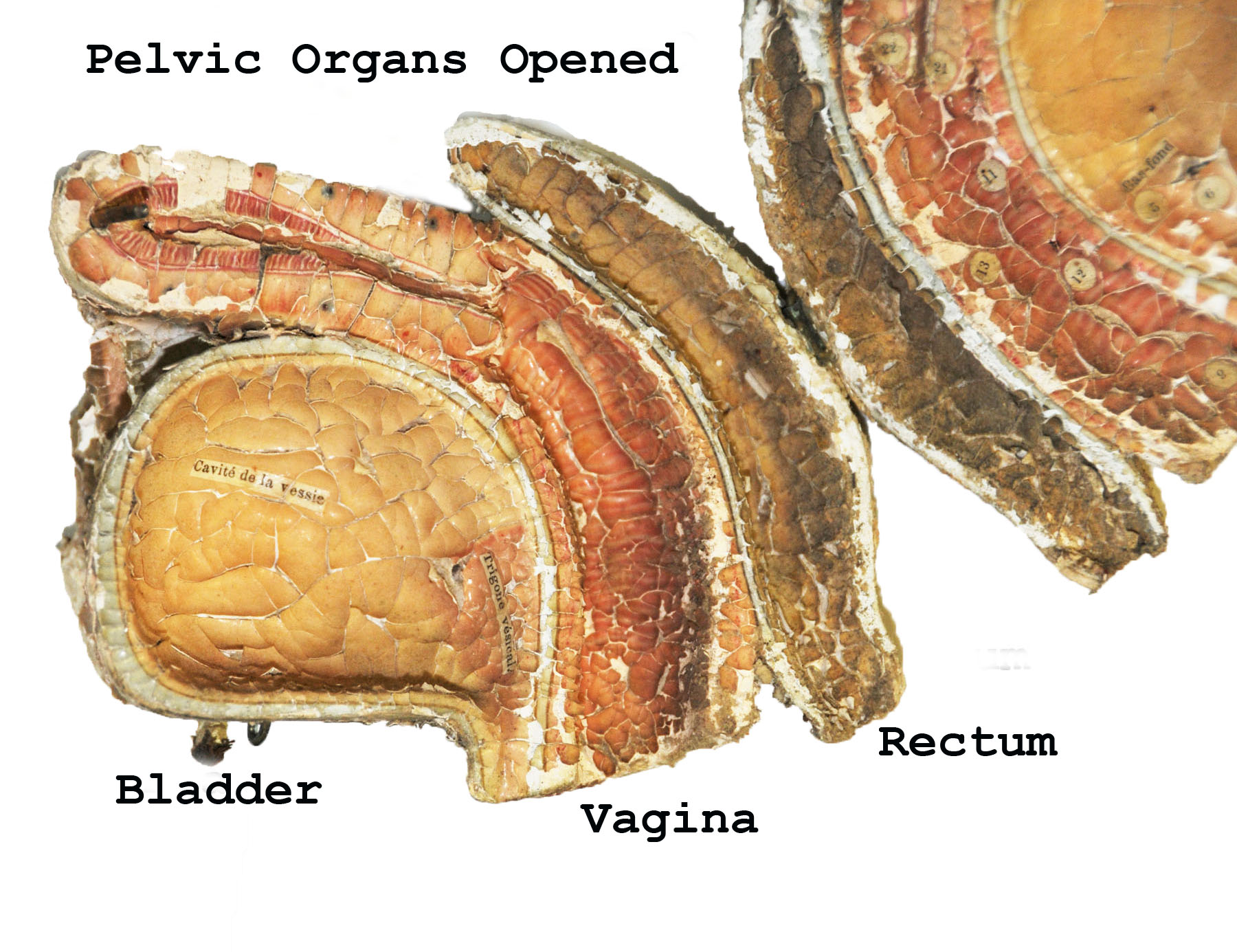 Magnified image for image #13