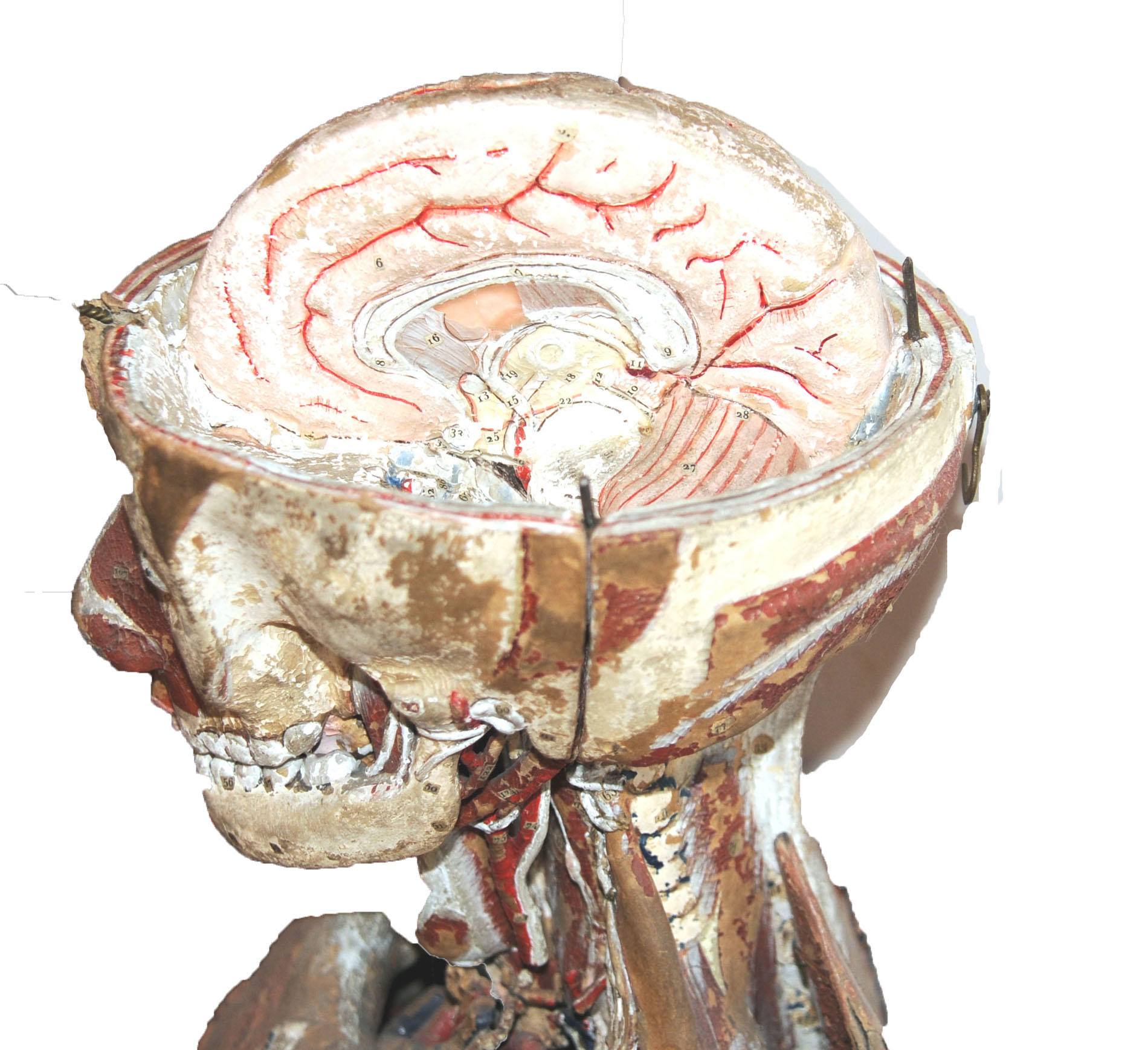 Magnified image for image #6