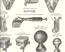 Photo of Bleeding and cupping (0bleeding_and_cupping)